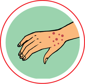 Dengue_flyer_3-care_and_symptoms_-_final-01.width-360