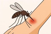 mosquito_bite.width-360